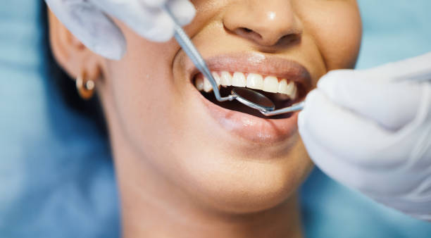 Best Emergency Dental Care for Broken or Chipped Teeth in West Des Moines, IA